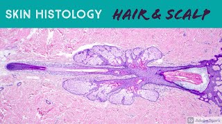 Hair follicle under microscope amp scalp skin histology dermatology dermpath pathology anatomy [upl. by Ynnos]