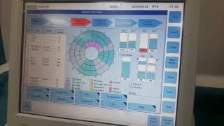 Roche Hitachi e411 Routine Maintenance [upl. by Cassilda]