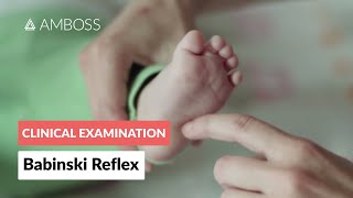 Babinski Reflex in Infants  Clinical Examination [upl. by Adieren374]