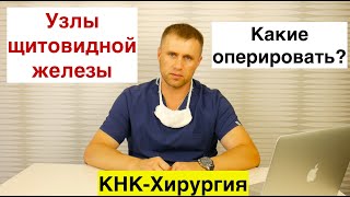 УЗИ Щитовидной железы Доброкачественные узлы щитовидки 4 варианта узлов Лекция Доктор Ушаков [upl. by Padraig]