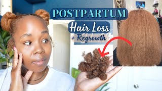 My Postpartum Hair Loss Shedding amp Regrowth  Real Tips amp Essential Products [upl. by Christina699]