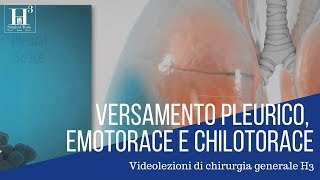 Versamento pleurico emotorace chilotorace [upl. by Ramon]