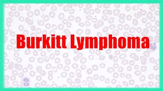 Burkitt lymphoma made easy  Speedy Medical Hematology [upl. by Primrose]