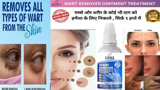 Which cream is best for wart removal 7 days Wart Removal Cream [upl. by Kettie]