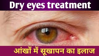 cmc eye drop used in hindi  tears top eye drop used in hindi  Tear Drops Eye Drops Uses in Hindi [upl. by Doris695]