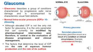 Treatment of Glucoma and eye drugs [upl. by Fe917]