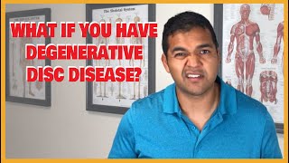 What Is Degenerative Disc Disease amp What To Do About It  El Paso Manual Physical Therapy [upl. by Jehovah]