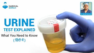 Urine Test Explained What You Need to Know [upl. by Akimas]