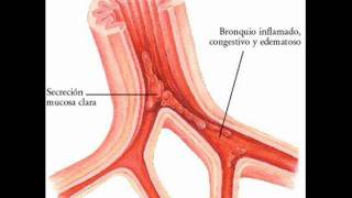 Sales de Schüssler para enfermedades respiratorias [upl. by Virendra]