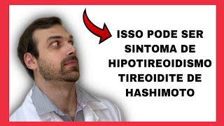 Tireoidite de Hashimoto e Hipotireoidismo  Sintomas e causas [upl. by Jurkoic375]