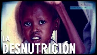 La desnutrición Documental Completo [upl. by Zadack]