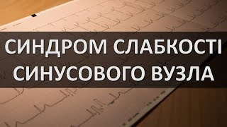 СИНДРОМ СЛАБКОСТІ СИНУСОВОГО ВУЗЛА ЕКГ ОЗНАКИ [upl. by Heins868]