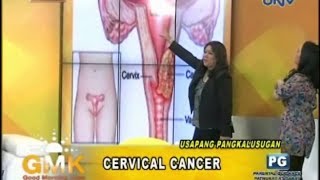 Understanding Cervical Cancer [upl. by Lelia79]