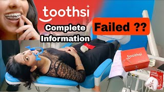 Toothsi Aligner Treatment FAILED  Invisible Braces Done WRONG  Toothsi Treatment Review 2023 [upl. by Ginger]