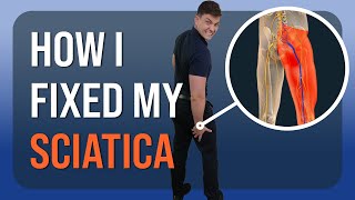 How I Healed My Sciatica Personal Recovery Story [upl. by Nyrb787]