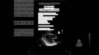 Effects of cardiogenic shock [upl. by Mirella490]