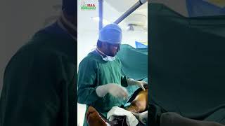 Varicose Veins Treatment maahospitals maaent EndovenousLaserTreatment shorts youtubeshorts [upl. by Knight]