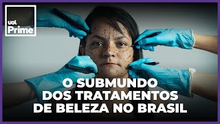 Do botox ao PMMA Brasil é paraíso de intervenções que são caso de polícia [upl. by Oicinoid]