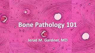 Bone Tumor Pathology 101 Osteosarcoma Chondrosarcoma and Mimics [upl. by Rodie]