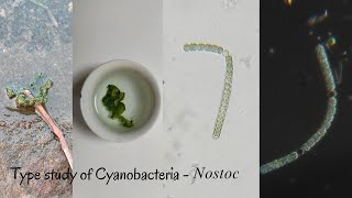 Type Study of Cyanobacteria  Nostoc [upl. by Doy]