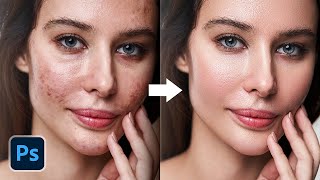 3 Superfast Ways to AutoRepair Skin  Free Actions  Photoshop Tutorial [upl. by Croteau123]