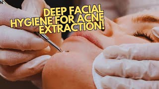 Deep Facial Extraction For Clear Skin  Blackheads Milia and Acne Treatment [upl. by Claiborn985]