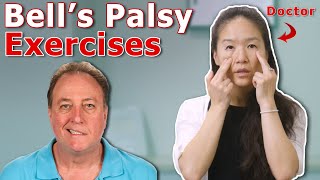 Easy Exercises For Bells Palsy Face Facial Paralysis  Unable to Smile  Physical Therapy [upl. by Lak]