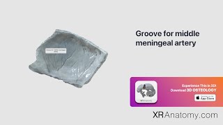 Parietal Bone  Groove for middle meningeal artery [upl. by Eelame]