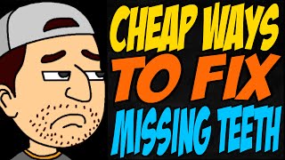 Cheap Ways to Fix Missing Teeth [upl. by Ttiwed]