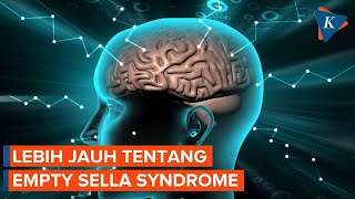 Mengenal Empty Sella Syndrome Penyakit yang Diidap Ruben Onsu [upl. by Dami5]