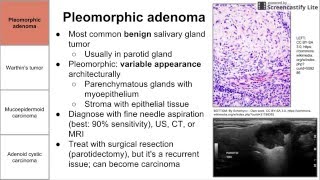 Salivary Gland Neoplasms [upl. by Anahsed348]