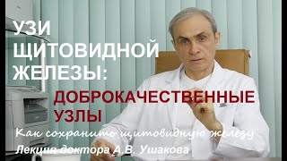 Вылечить гипотиреоз и убрать узлы на щитовидке поможет настой Как лечить гипотиреоз без гормонов [upl. by Atiken723]