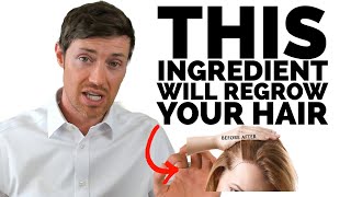 The BEST Hair Supplements Contain This Ingredient [upl. by Rab]