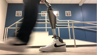 Hip disarticulation prosthetic gait demonstration 2022 [upl. by Anivel399]