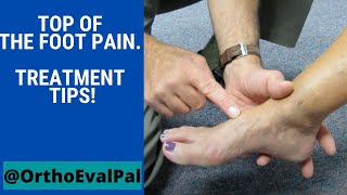 Top of the foot pain Treatment tips [upl. by Ybocaj]