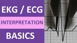 EKGECG Interpretation Basics Nursing NCLEX  QRS Complex P Wave T Wave PR Interval [upl. by Casabonne]