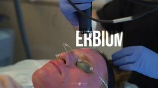 Erbium Fractional Laser  Live with Dr Jason Emer [upl. by Ahsenid]