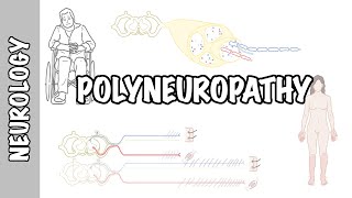 Approach to Polyneuropathy  causes pathophysiology investigations [upl. by Ivatts367]