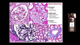 Basics of Pathology by Dr Ritambra Nada  ISN SRC IndiaNigeria Program [upl. by Ybanrab]