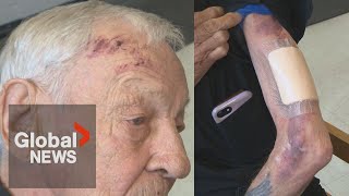 quotAppallingquot 82yearold veteran in BC swarmed beaten during scooter ride home [upl. by Akcirret]