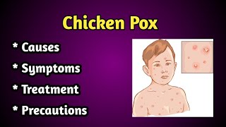 Chicken Pox causes Symptoms and Treatment [upl. by Hera]