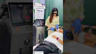 Laser Hair Removal for underarms at Tira Clinic Rohtak laser laserhairremoval hairremoval [upl. by Bortman609]