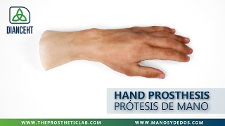 Prótesis de Mano de DIANCEHT  Hand Prosthesis No 274 [upl. by Tolmach]