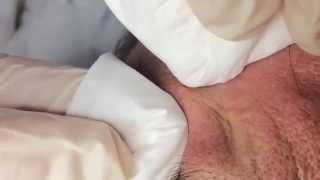 How To Remove a Whitehead Soft Sebum [upl. by Alset803]