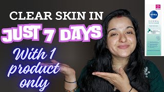 Achieve Clearer Skin in Just 7 Days  Nivea Derma Clear Review  The Slaying Soul [upl. by Esinnej]