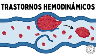 TRASTORNOS HEMODINÁMICOS Hiperemia Congestión Edema Efusión Hemostasia Trombosis y Embolismo [upl. by Somerset]