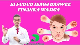 FINANKA WAJIGA SIDA UGU FUDUD EE LEYSAGA DAAWEEYO IYO WAXYAABAHA KEENO  Dr faris [upl. by Eyt867]