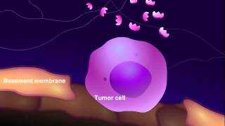 Introduction to Cancer Biology Part 3 Tissue Invasion and Metastasis [upl. by Saturday]