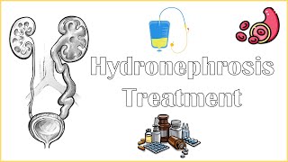 Hydronephrosis Treatment  Medical amp Surgical Management Of Hydronephrosis [upl. by Delacourt182]