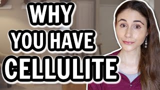 10 TIPS how to get rid of cellulite on thighs and bum [upl. by Aletsirc]